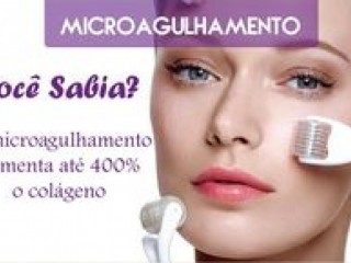 Curso microagulhamento tratamento de pele